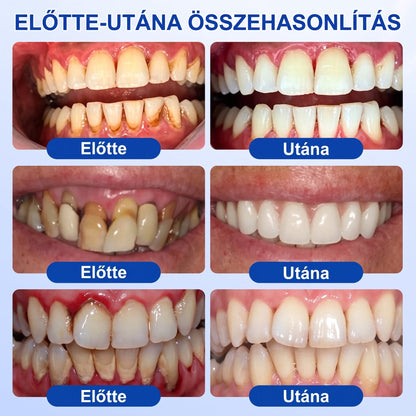 🇭🇺🏅🦷 HIVATALOS ÜZLET | Dr.Era® GumRevive Periodontal Repair Gel — Célzott fogínyápolás lepedék, fogszuvasodás, fogágyproblémák, kellemetlen lehelet és gyenge fogak esetén | Precíziós, leöblítést nem igénylő szájápoló formula