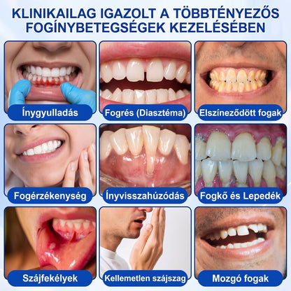 🇭🇺🏅🦷 HIVATALOS ÜZLET | Dr.Era® GumRevive Periodontal Repair Gel — Célzott fogínyápolás lepedék, fogszuvasodás, fogágyproblémák, kellemetlen lehelet és gyenge fogak esetén | Precíziós, leöblítést nem igénylő szájápoló formula