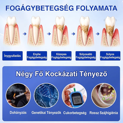 🇭🇺🏅🦷 HIVATALOS ÜZLET | Dr.Era® GumRevive Periodontal Repair Gel — Célzott fogínyápolás lepedék, fogszuvasodás, fogágyproblémák, kellemetlen lehelet és gyenge fogak esetén | Precíziós, leöblítést nem igénylő szájápoló formula