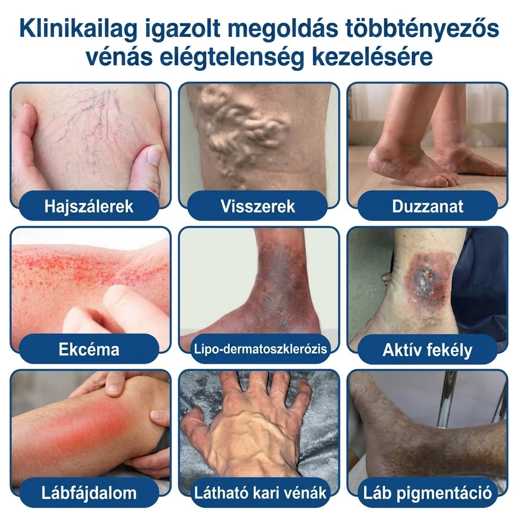 ✨🌿Medistart® Visszérápoló Mikrotűs Gondozó Tapasz ⚡ Azonnali Megkönnyebbülés, Hosszú Távú Eredmények