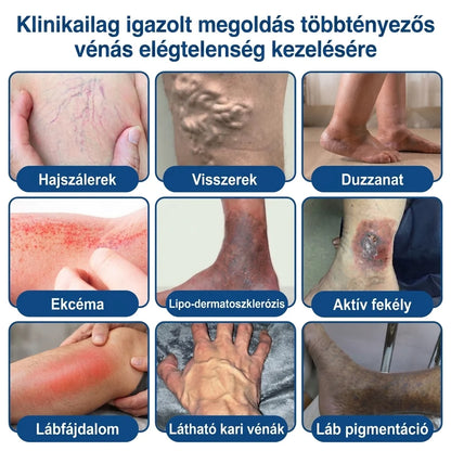 ✨🌿Medistart® Visszérápoló Mikrotűs Gondozó Tapasz ⚡ Azonnali Megkönnyebbülés, Hosszú Távú Eredmények