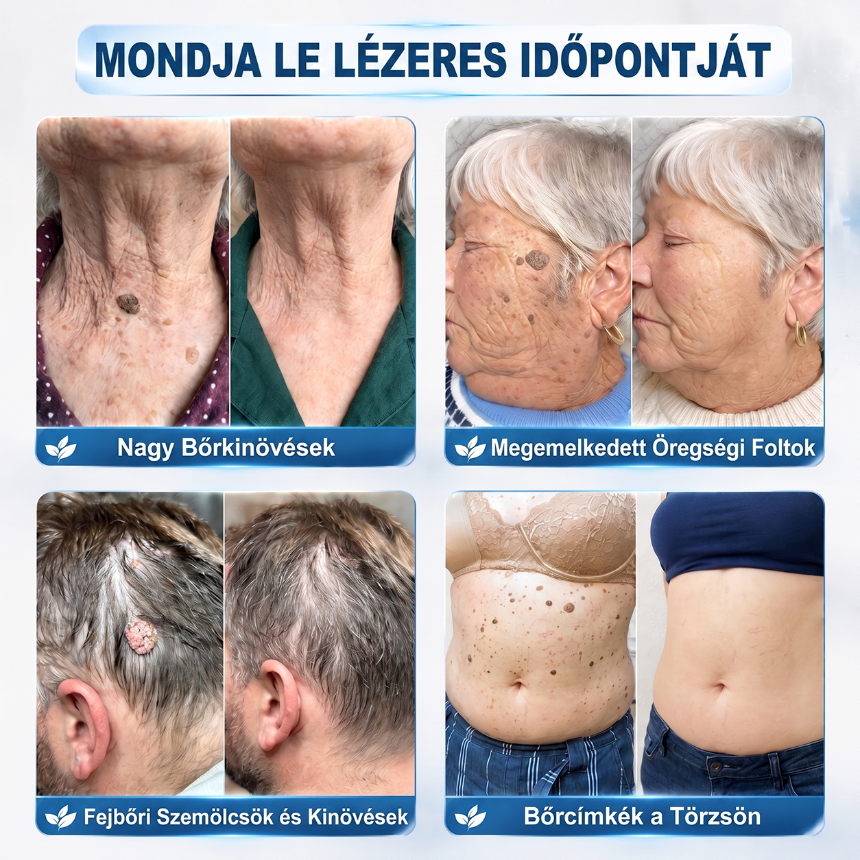 🎁 Már csak 5 doboz maradt! További 50% kedvezményt kínálunk Önnek! Lendüljön formába és legyen egészséges. Fogyjon le most, különben jövő évig nem lesz rá más esélye.