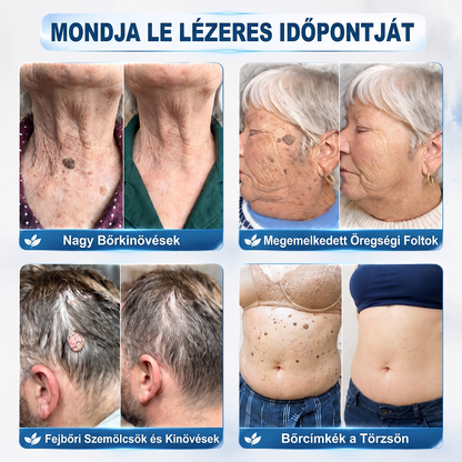 🎁 Már csak 5 doboz maradt! További 50% kedvezményt kínálunk Önnek! Lendüljön formába és legyen egészséges. Fogyjon le most, különben jövő évig nem lesz rá más esélye.