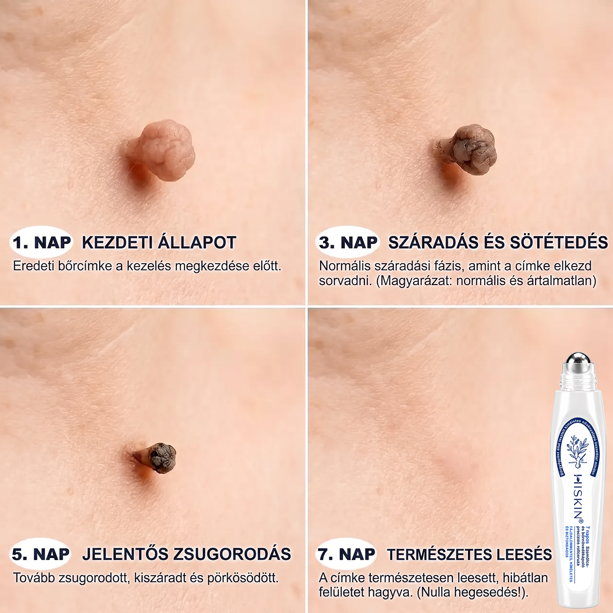 🎁 Már csak 5 doboz maradt! További 50% kedvezményt kínálunk Önnek! Lendüljön formába és legyen egészséges. Fogyjon le most, különben jövő évig nem lesz rá más esélye.