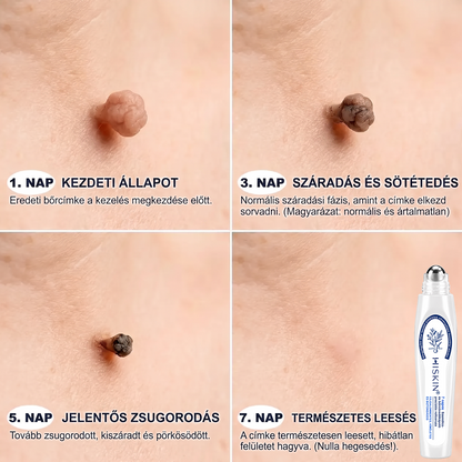 🎁 Már csak 5 doboz maradt! További 50% kedvezményt kínálunk Önnek! Lendüljön formába és legyen egészséges. Fogyjon le most, különben jövő évig nem lesz rá más esélye.