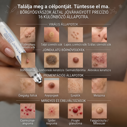 🎁 Már csak 5 doboz maradt! További 50% kedvezményt kínálunk Önnek! Lendüljön formába és legyen egészséges. Fogyjon le most, különben jövő évig nem lesz rá más esélye.